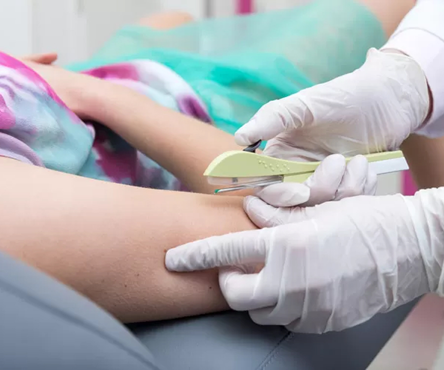 Implante anticoncepcional - Dra. Erika Nerusa